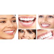 $39 For 2 Consecutive 20 Minute Wavelight Teeth Whitening Treatments ($ Value)